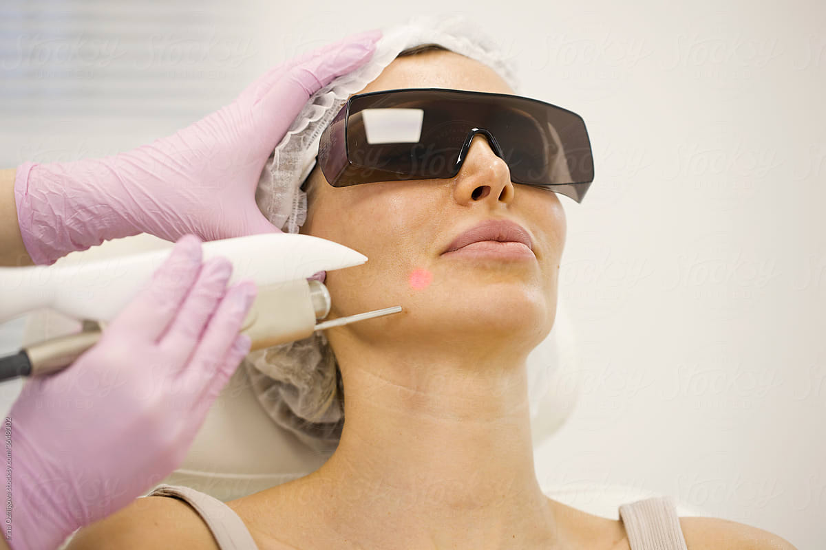 Young woman getting laser procedure on a face