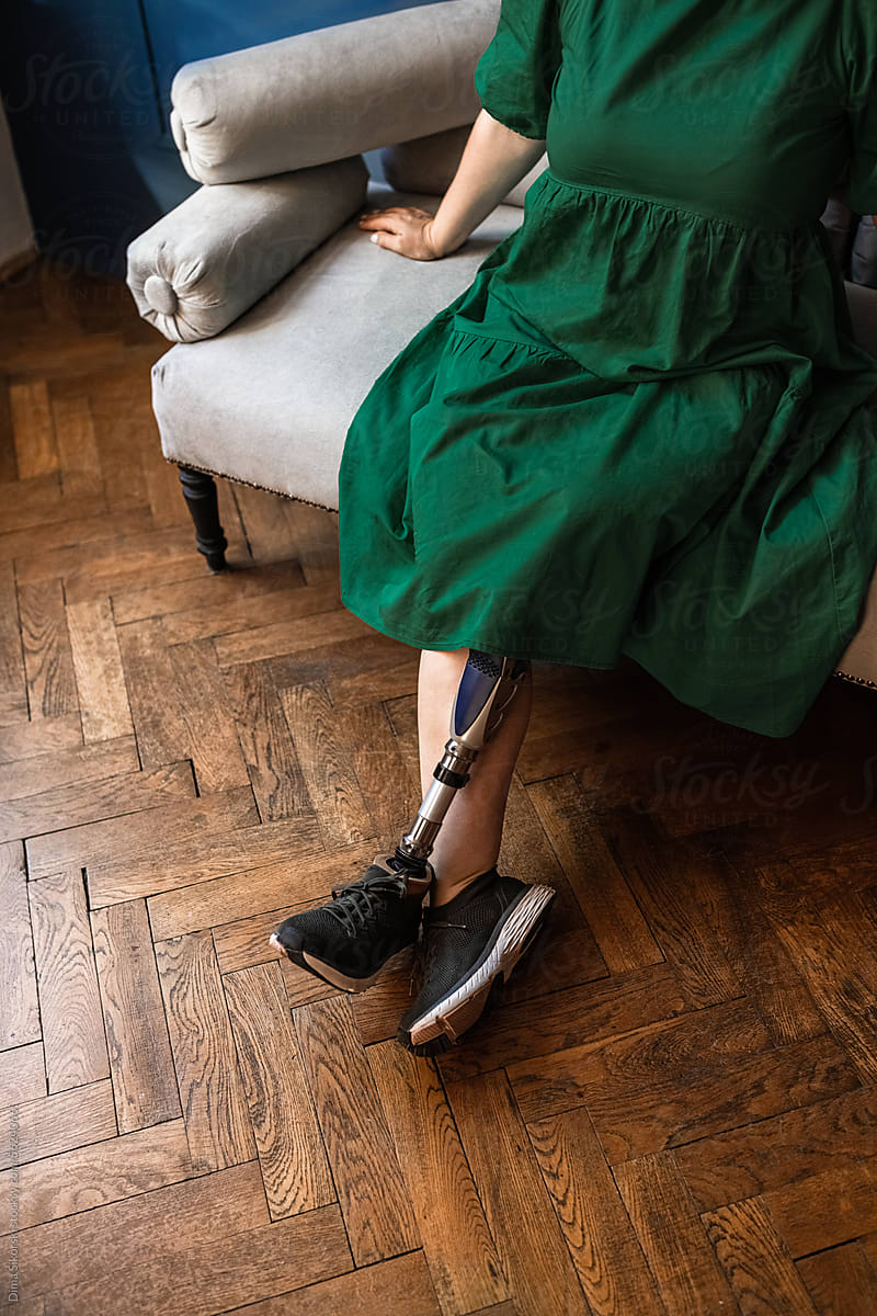 A disabled person with a prosthesis is resting on the sofa