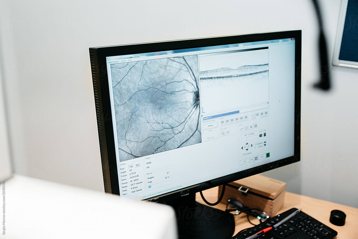 Results of the eye examination on the computer screen