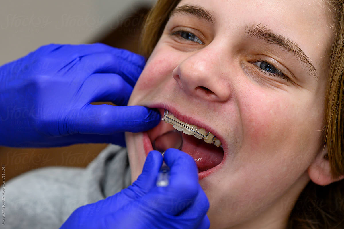 Patient at Orthodontics Office with Mouth Open