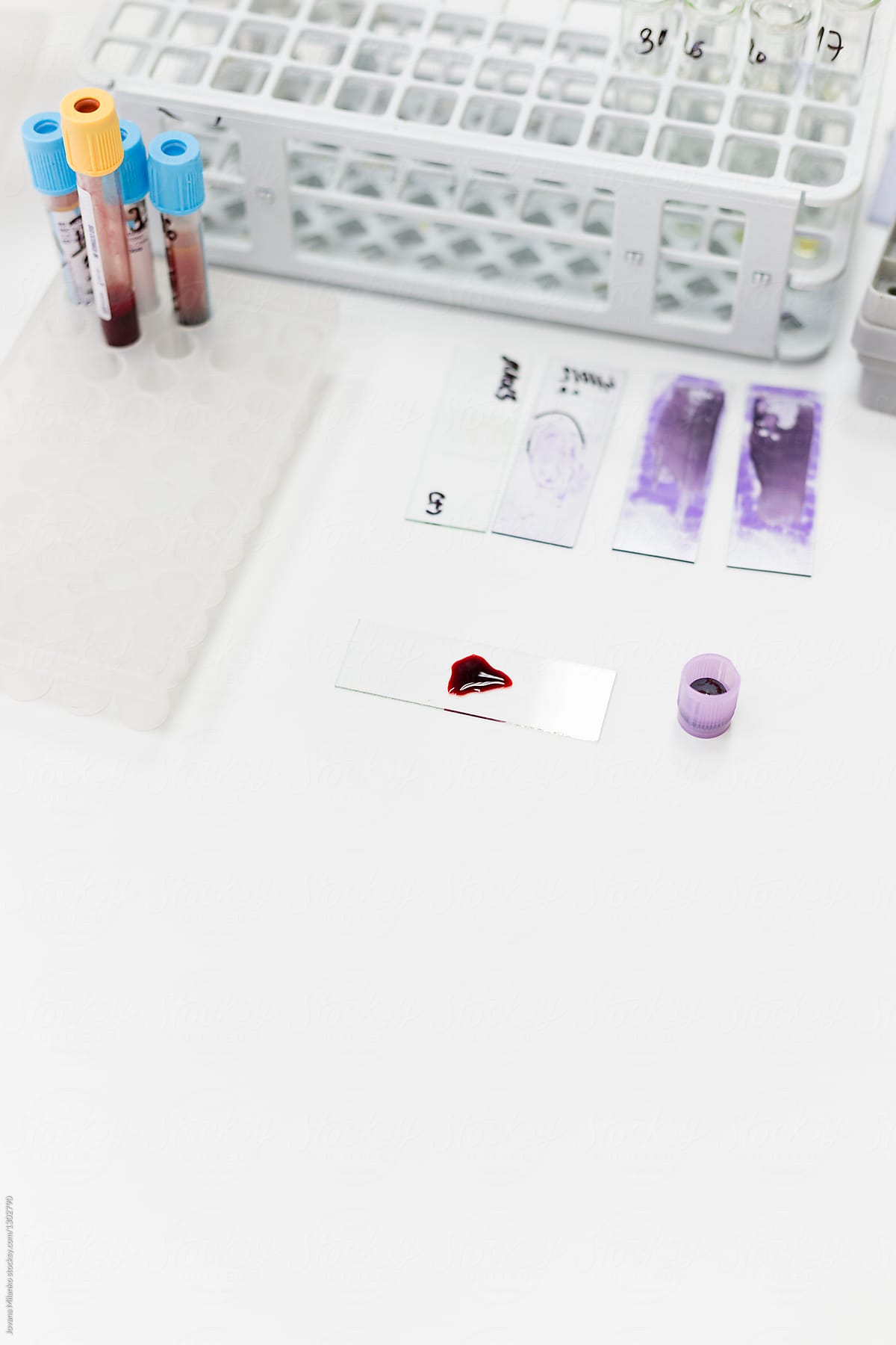 Blood samples being tested in a lab