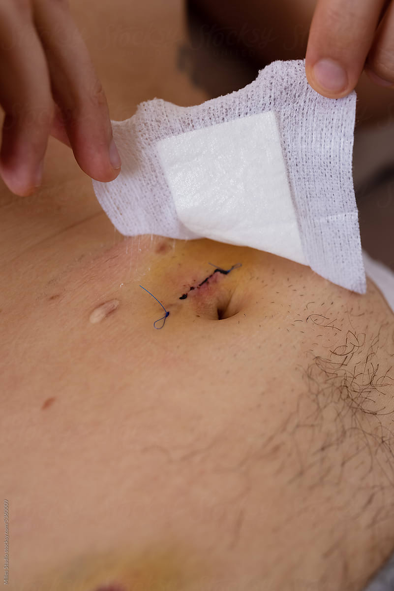 Crop man removing patch from tummy with stitch