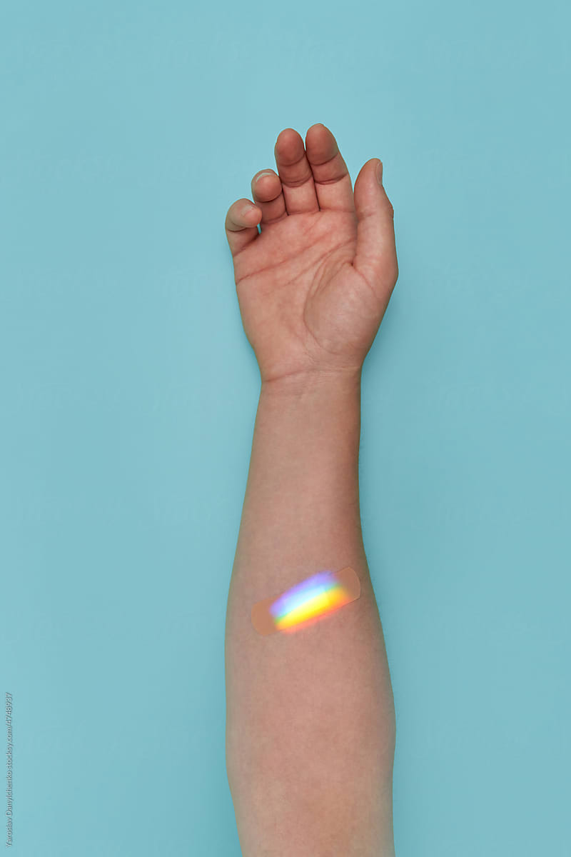 Rainbow effect over plaster on person\'s arm.