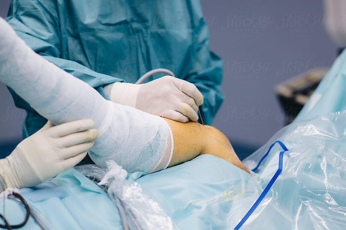 Surgeons performing arthroscopic shoulder operation