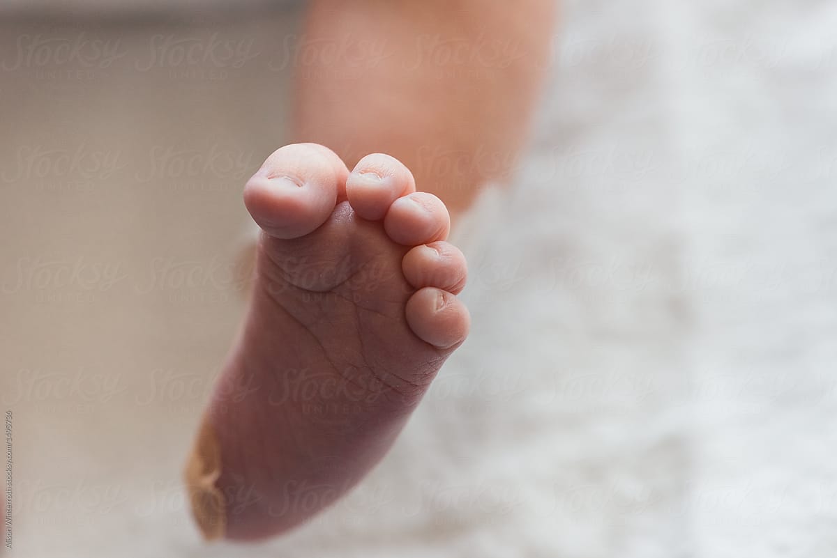 A Baby With Curled Toes And A Bandage On Her Heel