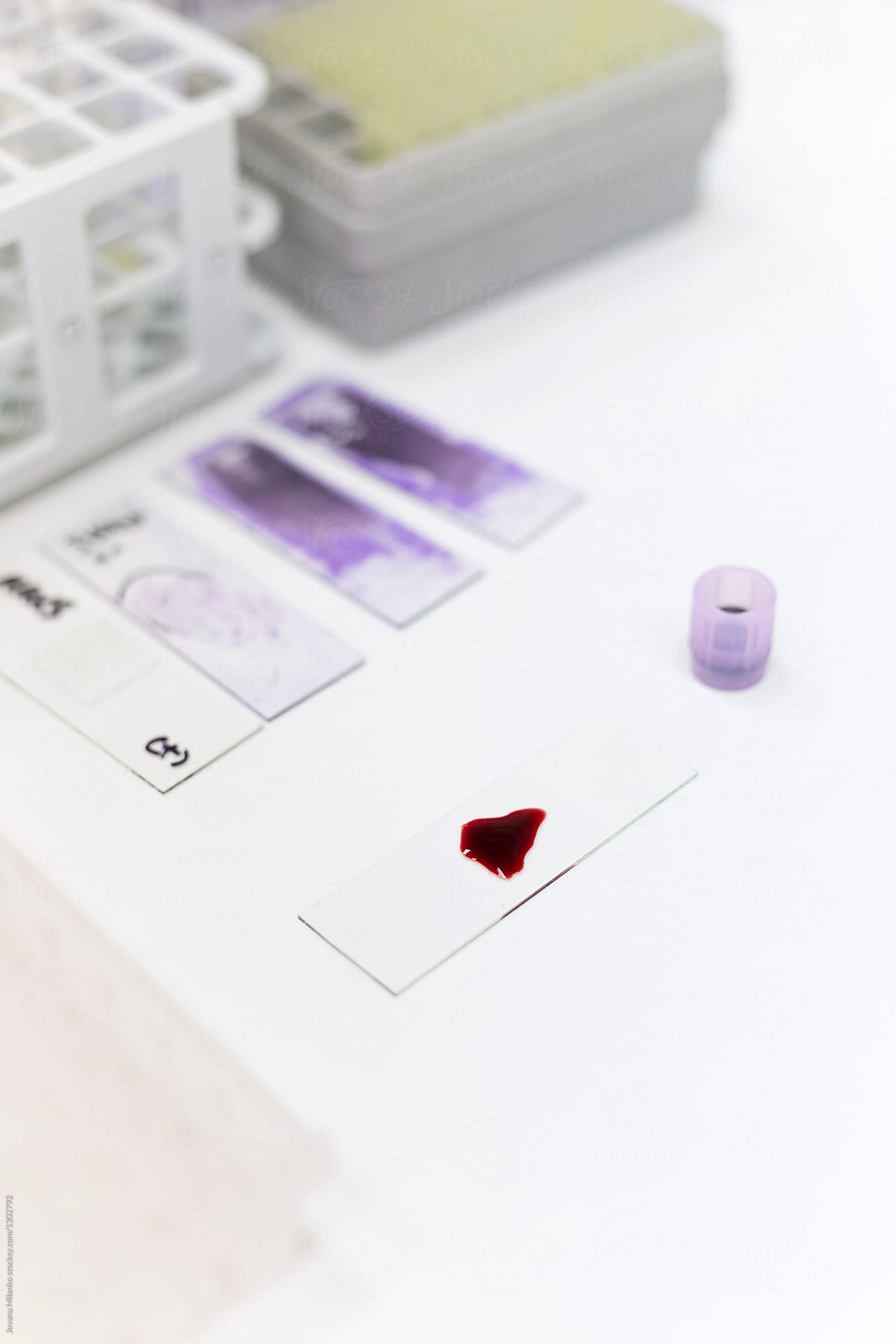 Blood samples being tested in a lab
