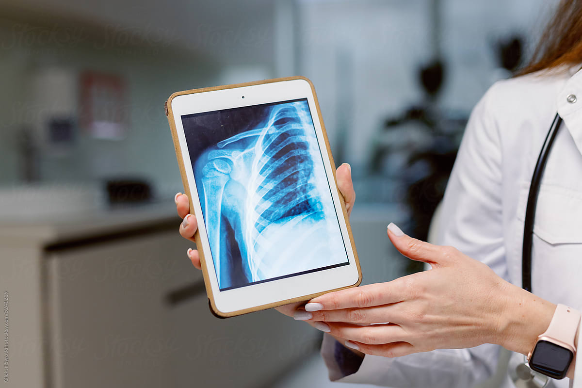 Tablet display chest radiography digital anatomy health