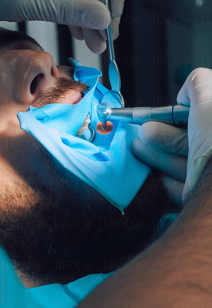 Detail  of patient teeth during dental surgery