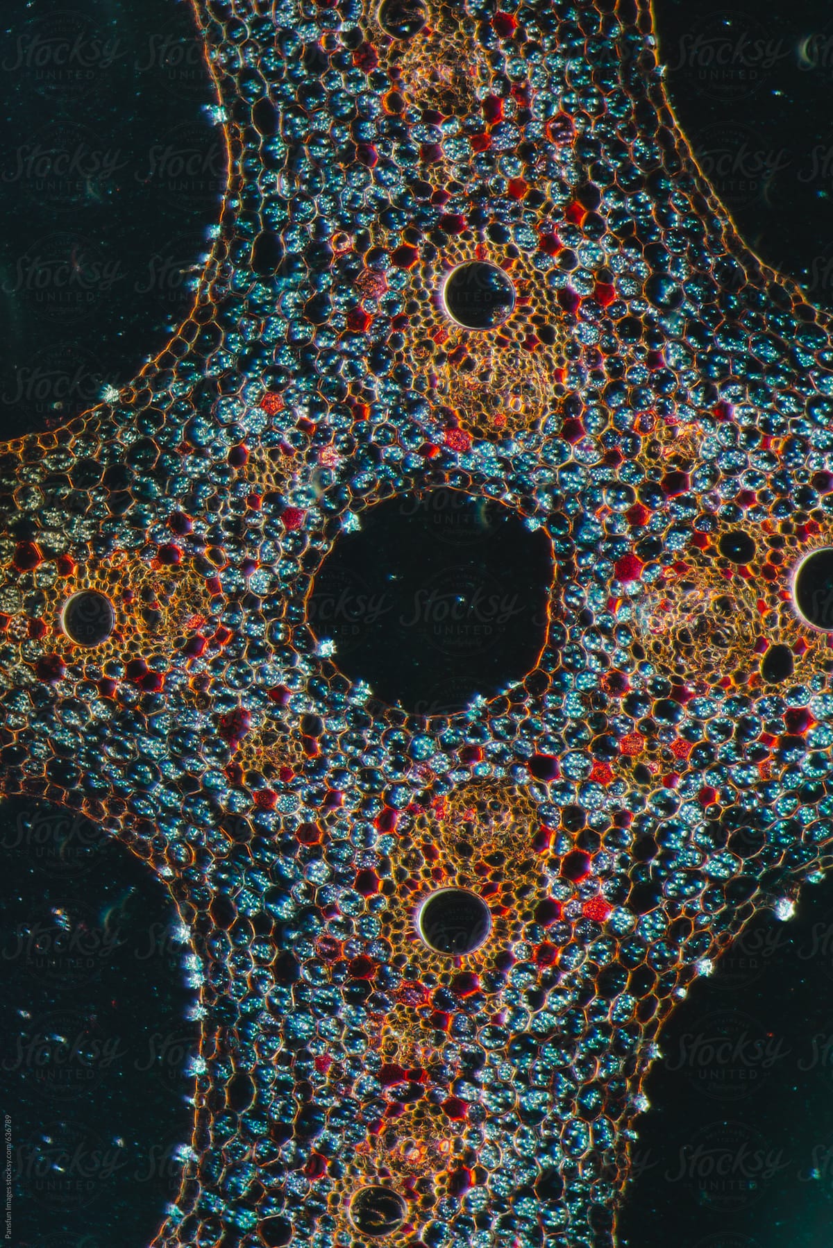 plant cells micrograph
