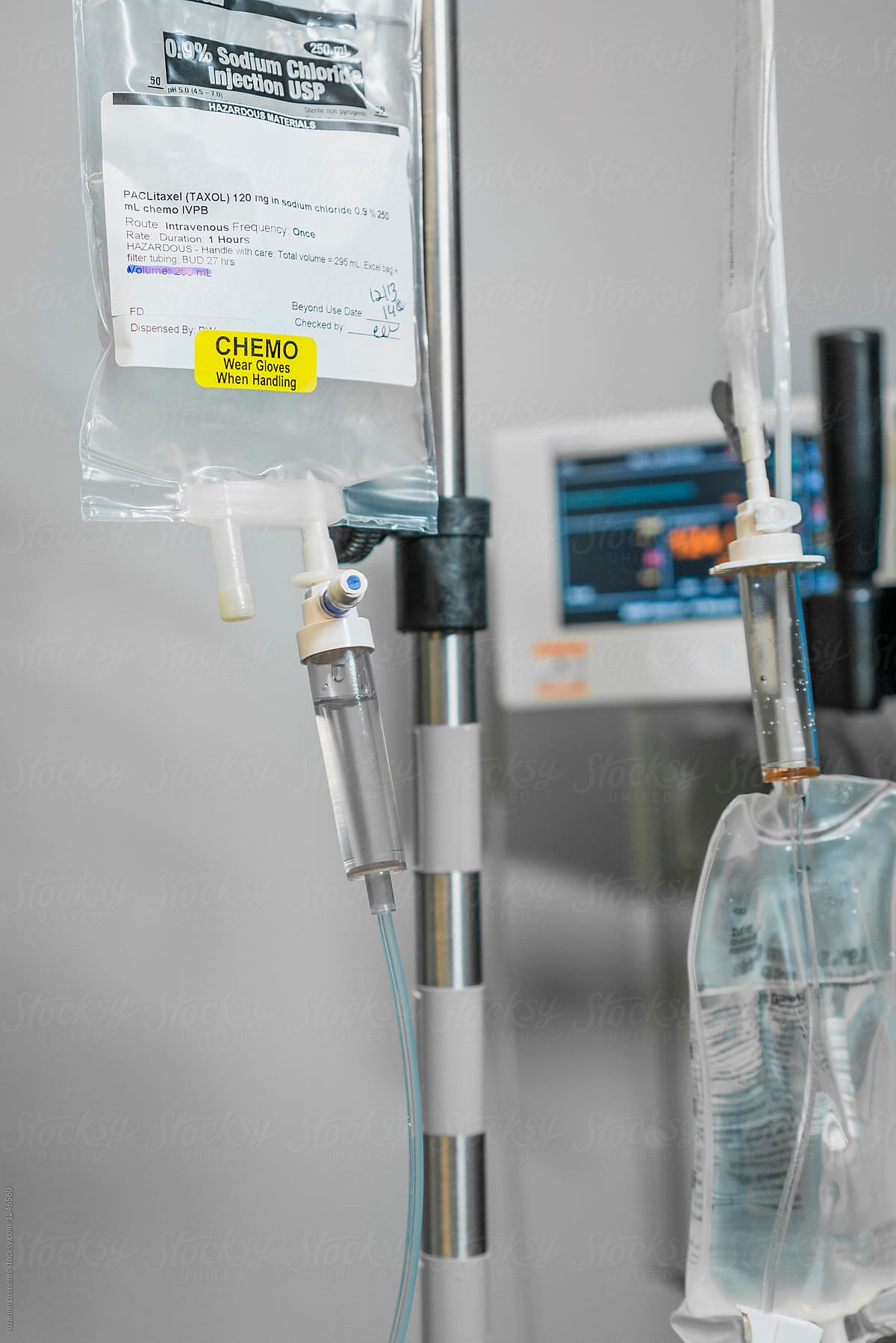 IV Infusion of Chemo Cancer Treatment