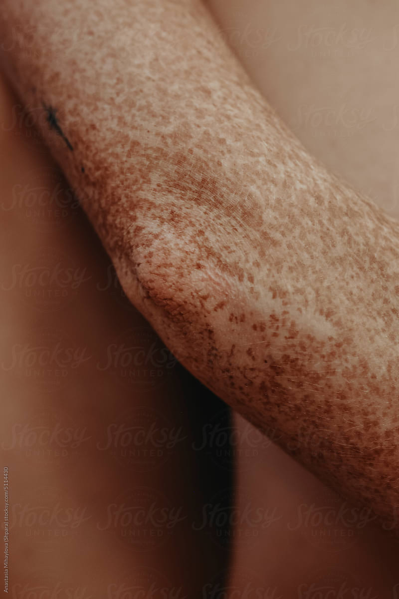 Close-up women's twisted arms and elbow in freckles skin texture