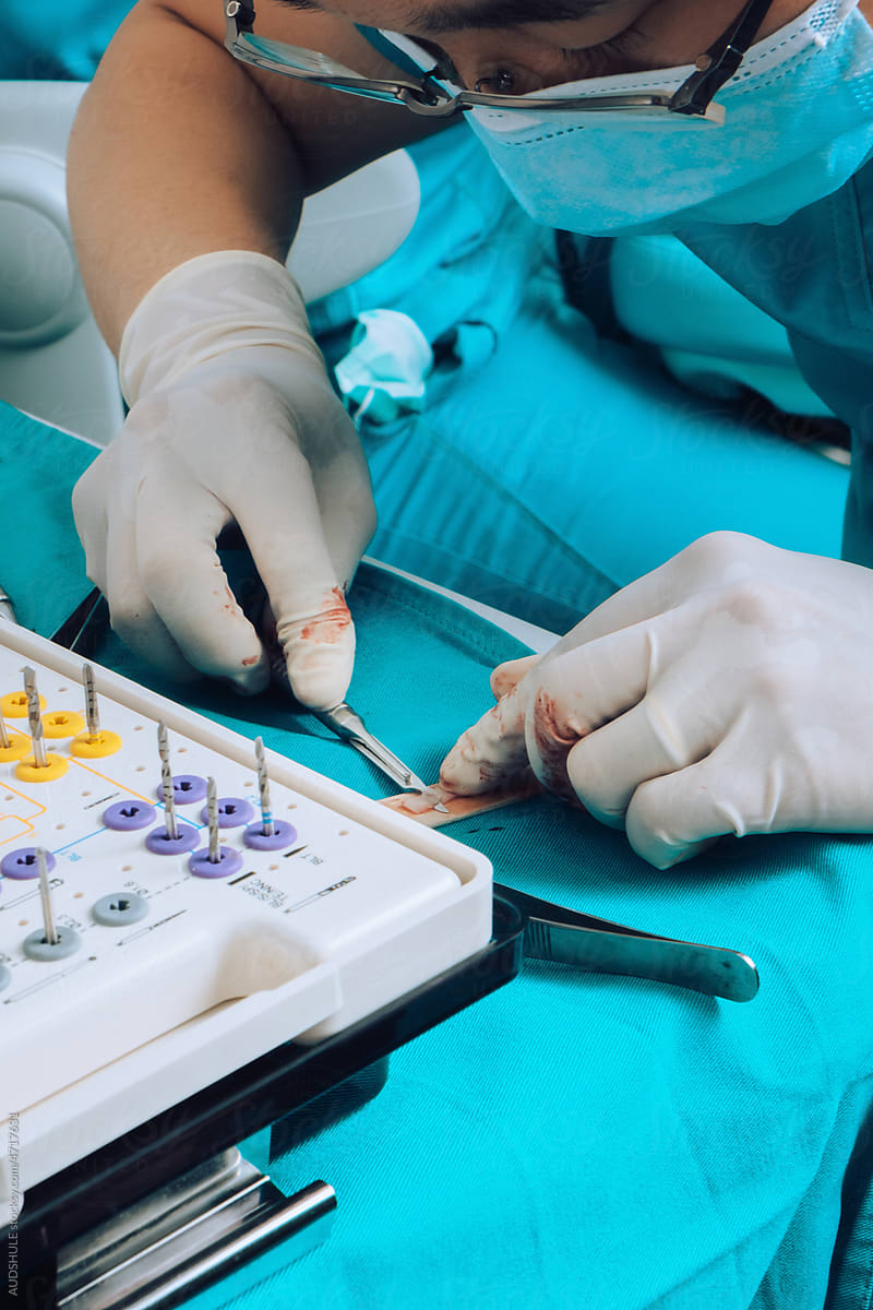 Dental Surgeon during surgery on teeth implants