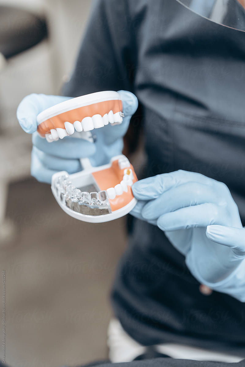 The dentist holds a model of the teeth.