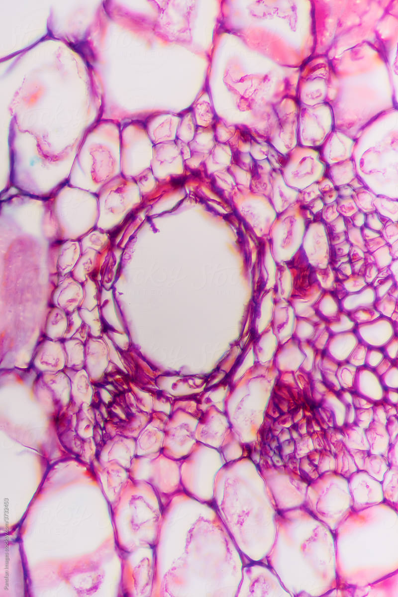 gallnut plant cells micrograph
