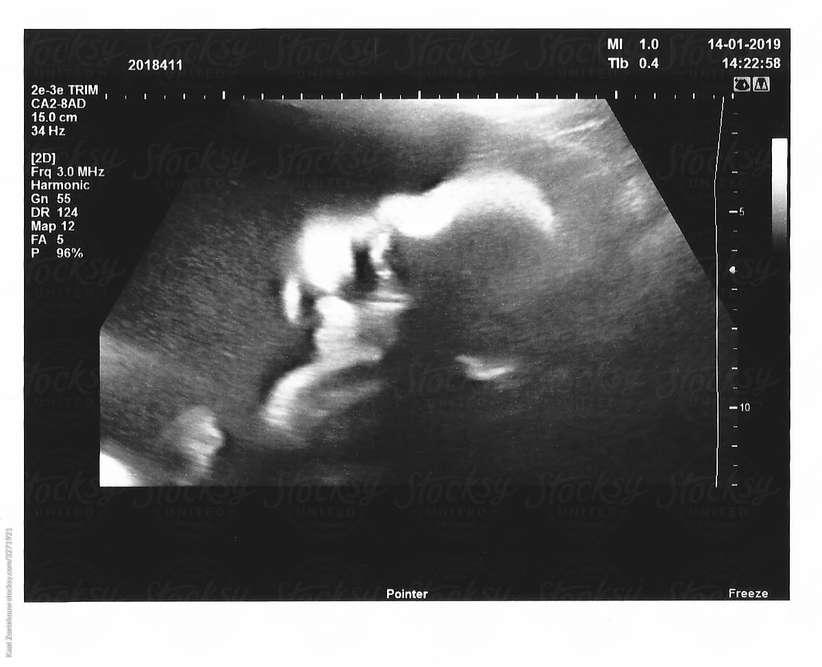 Dreamy ultrasound close-ups