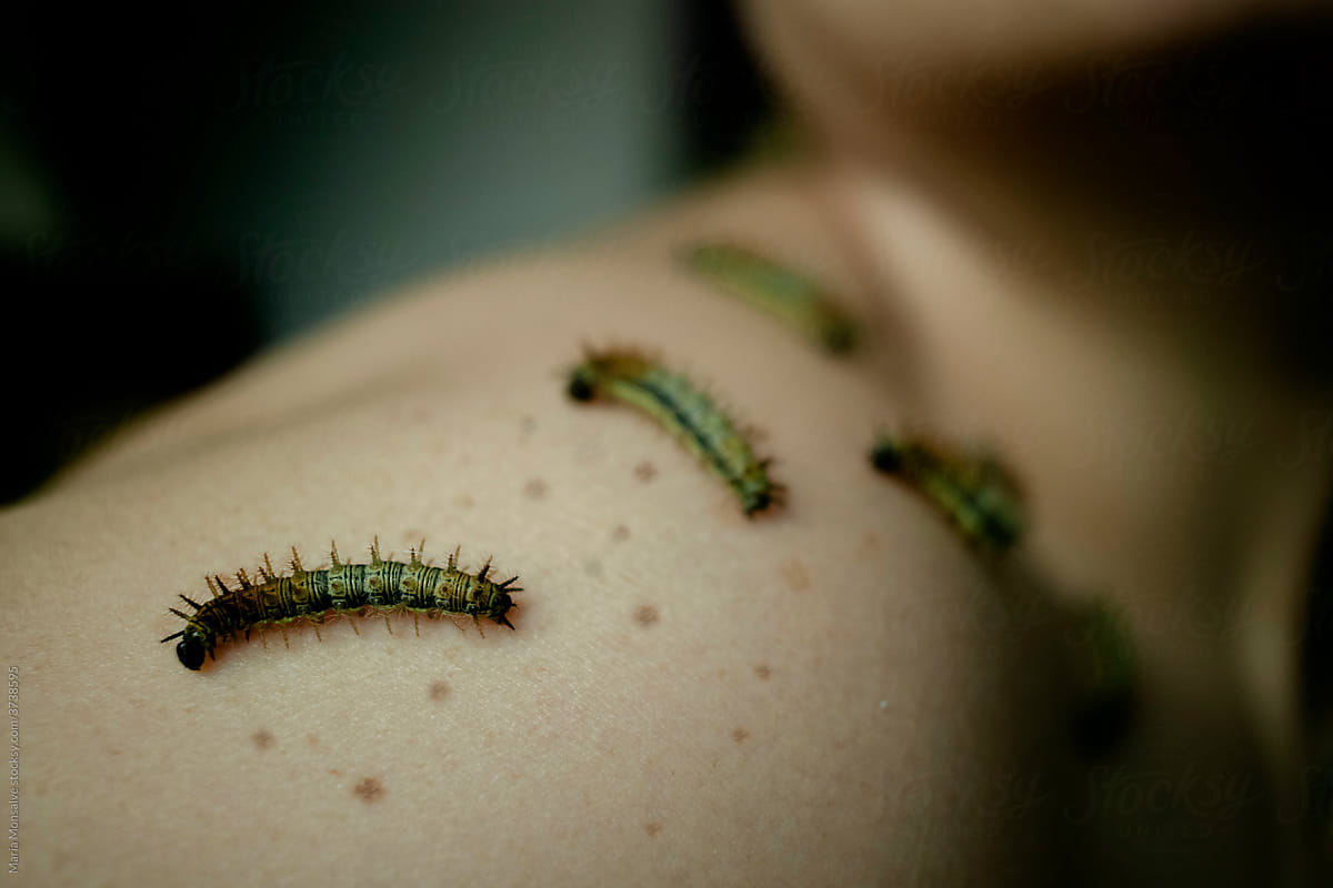Caterpillars on naked skin