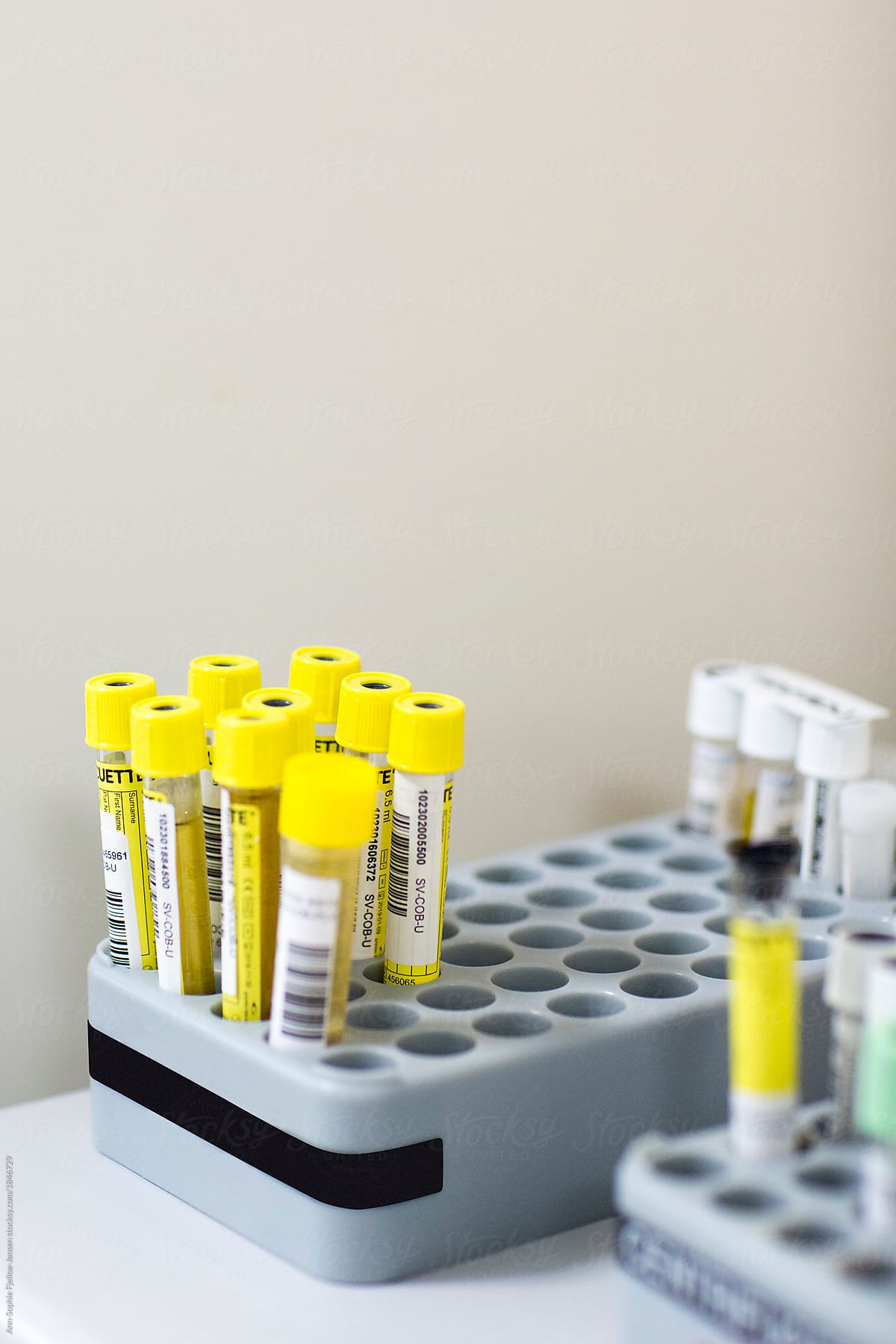 Blood sample tubes
