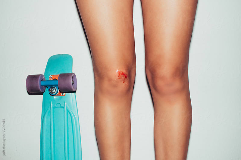 Skinny tan girl with her skateboard and a scraped knee