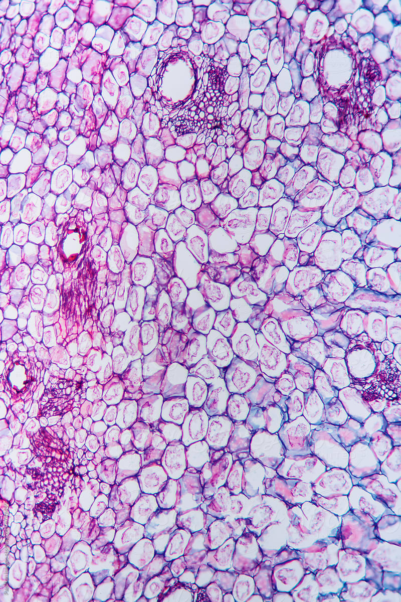 gallnut plant cells micrograph