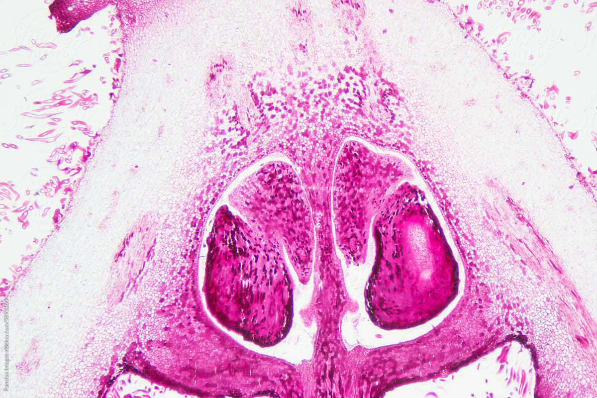 loquat flower plant cells micrograph