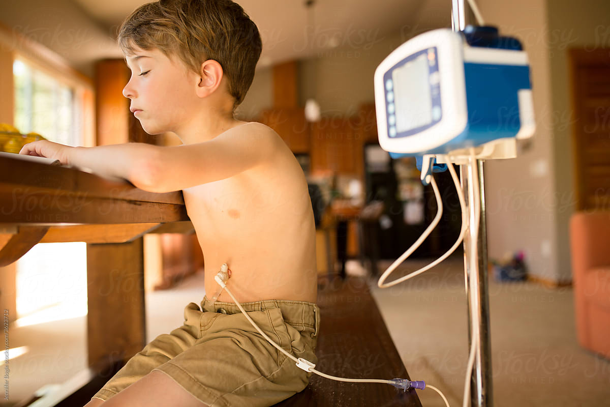 Boy sits at dining room table with feeding pump attached to g-tube port