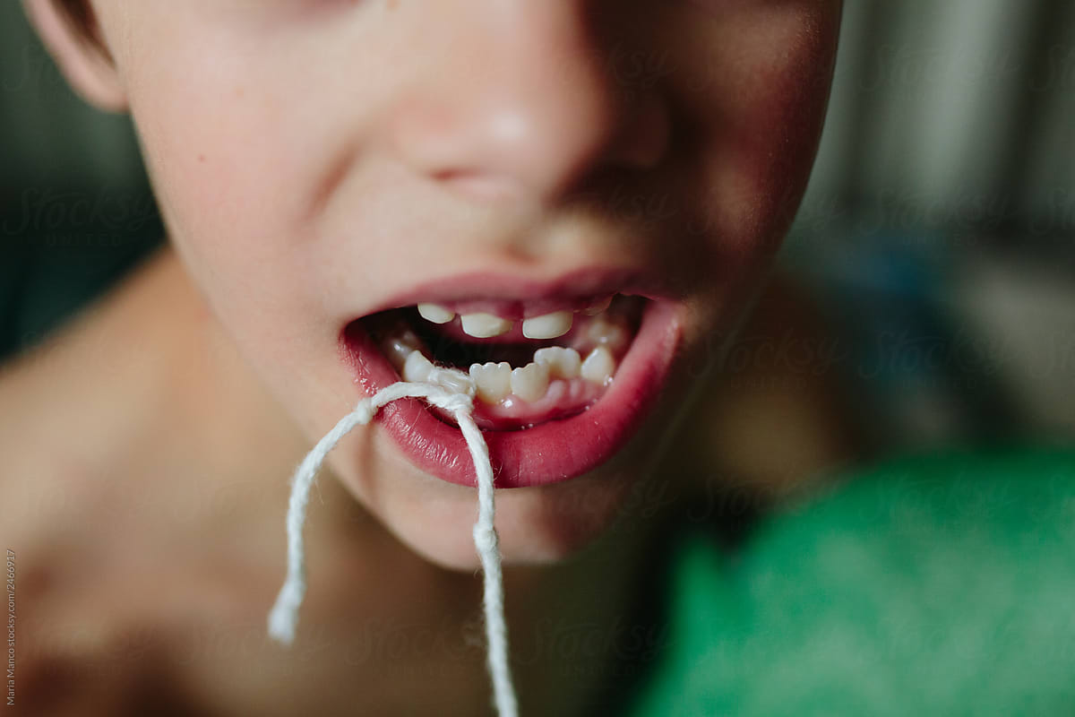 boy ties string around loose tooth